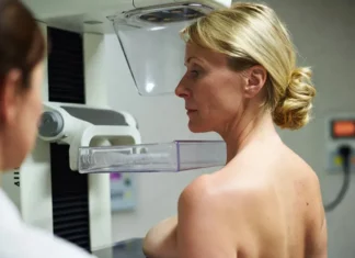 Dépistage du cancer du sein à partir de 50 ans