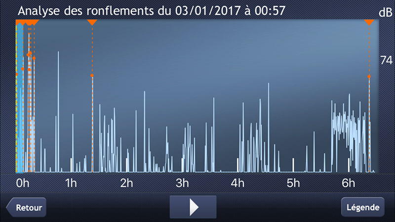 Vous pourrez écouter vos ronflements capturés grâce au microphone